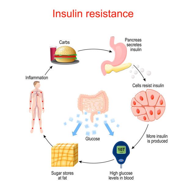 Insulin resistance