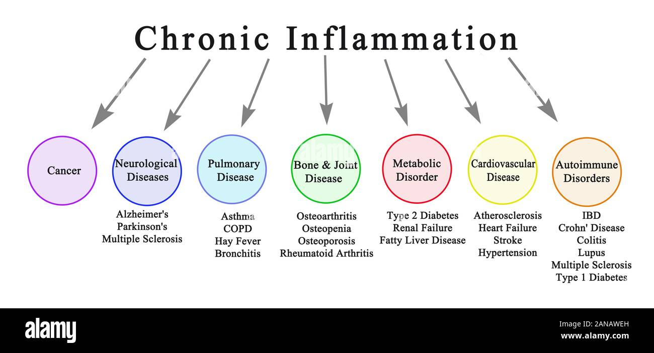 How To Reduce Inflammation Fast and Help Your Hormones Too Sally how-to-reduce-inflammation-fast-and-help-your-hormones-too-sally